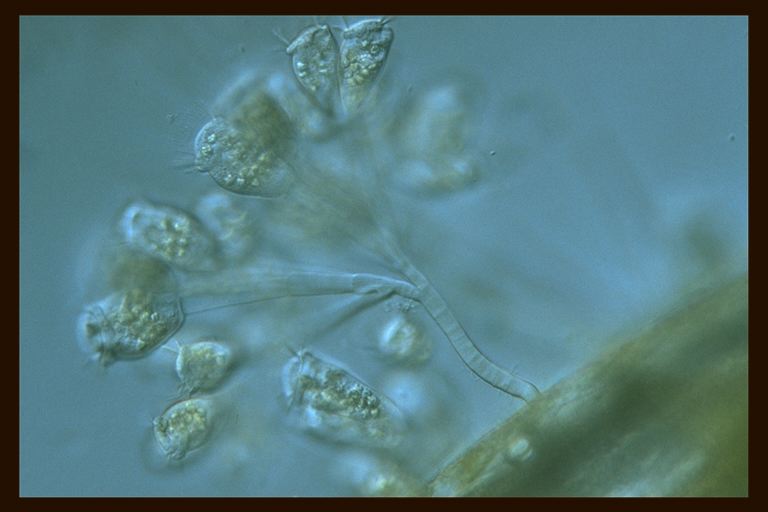 Epistylis sp.